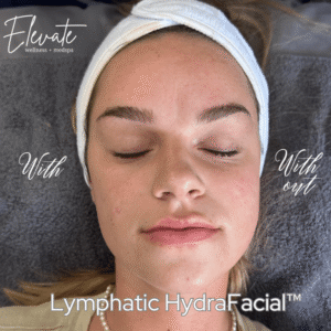 Best Lymphatic Drainage Massage Near Me Elevate Wellness