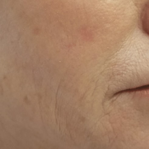 neck treatments near me
