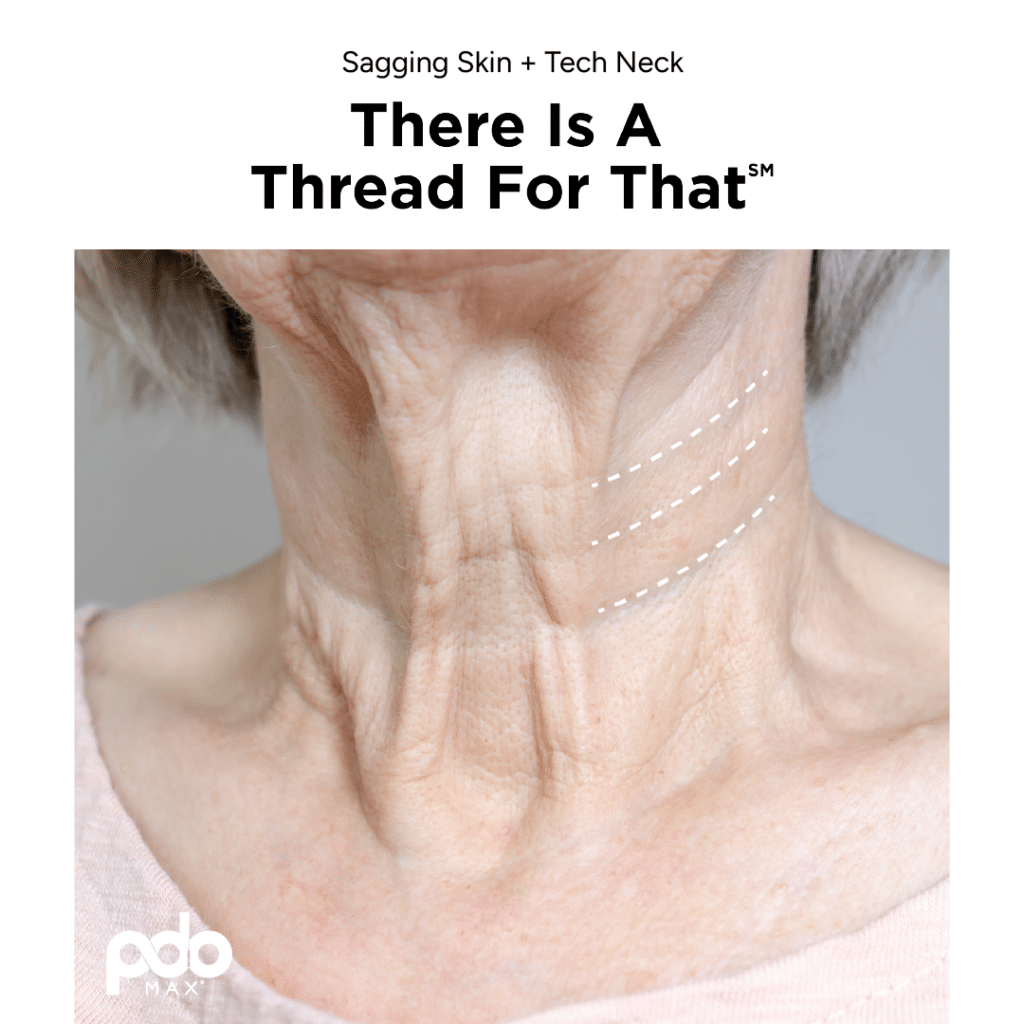 Sagging Skin + Tech Neck - There is a Thread for that